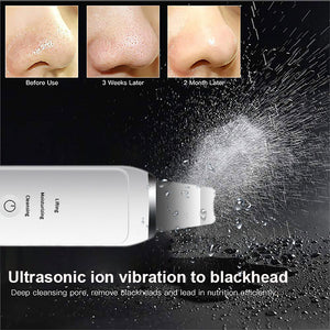 All in One Ultrasonic Skin Blackhead Remover