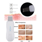 All in One Ultrasonic Skin Blackhead Remover